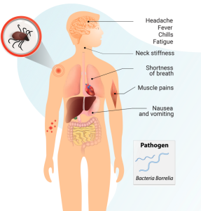 a human showing signs of lyme disease symptoms and is in need of a lyme test